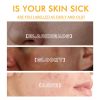 EELHOE Brightening Peel Mask Gently Cleans Skin, s Facial Dullness, Hydrates And Moisturizes Peel Mask