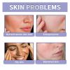 Eelhope Lavender Matte Powder, Mist Face Matte Light And Easy To Take Off Makeup Natural Long-Lasting Setting Powder